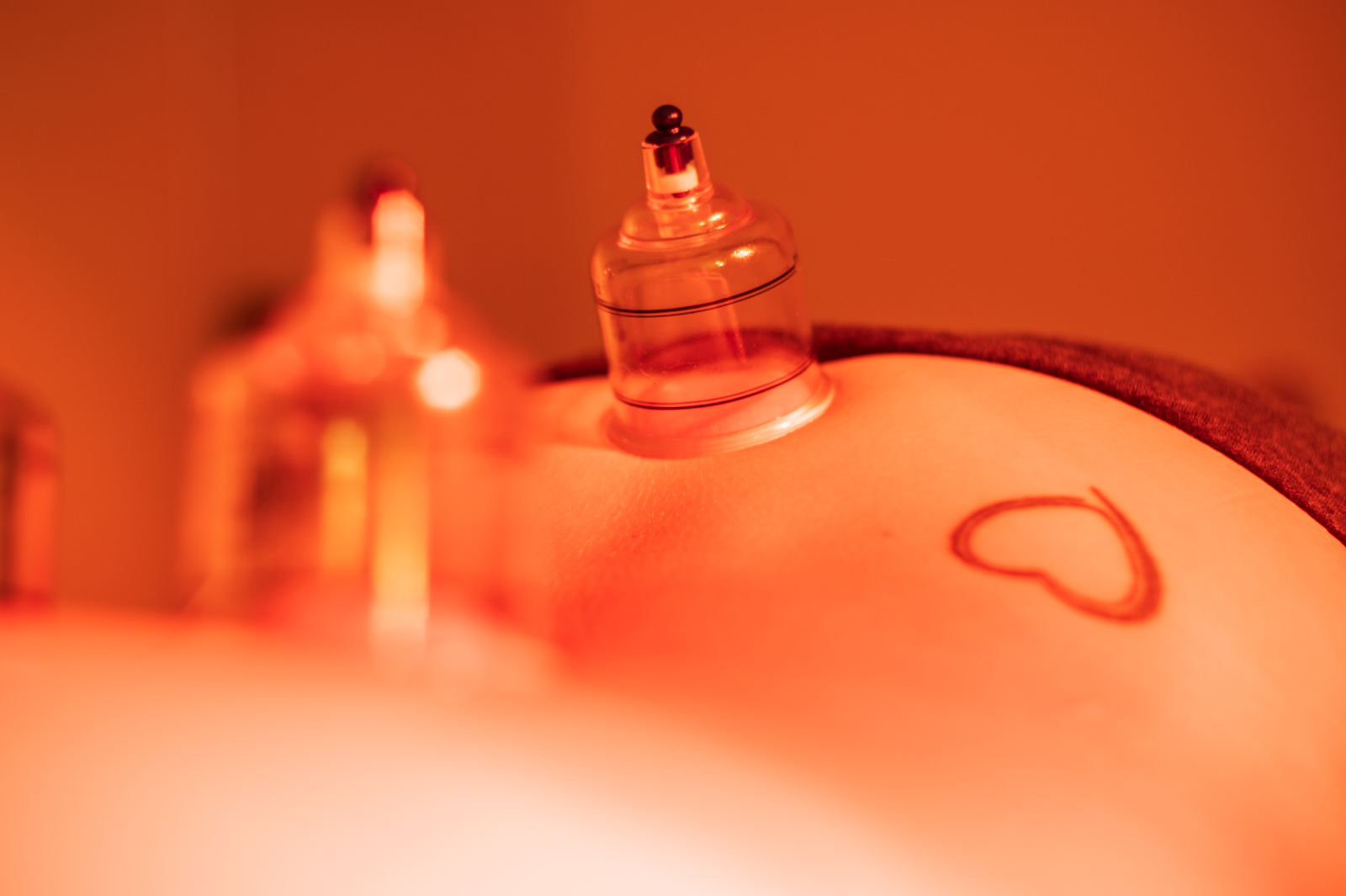 Therapeutic sucction cups placed on a womans back for Cupping Therapy Therapeutic sucction cups placed on a womans back for Cupping Therapy